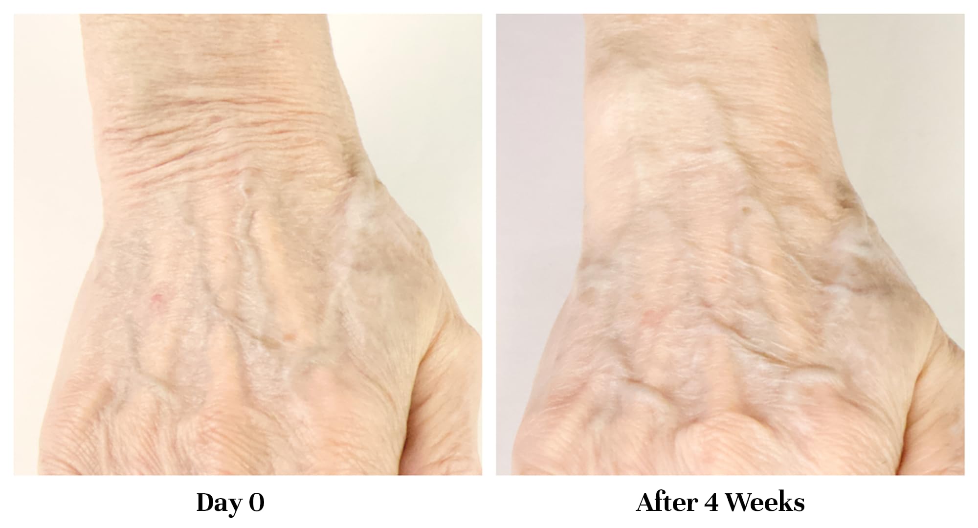 City Beauty Restoring Hand Treatment cream swirl showing rich, fast-absorbing hydration