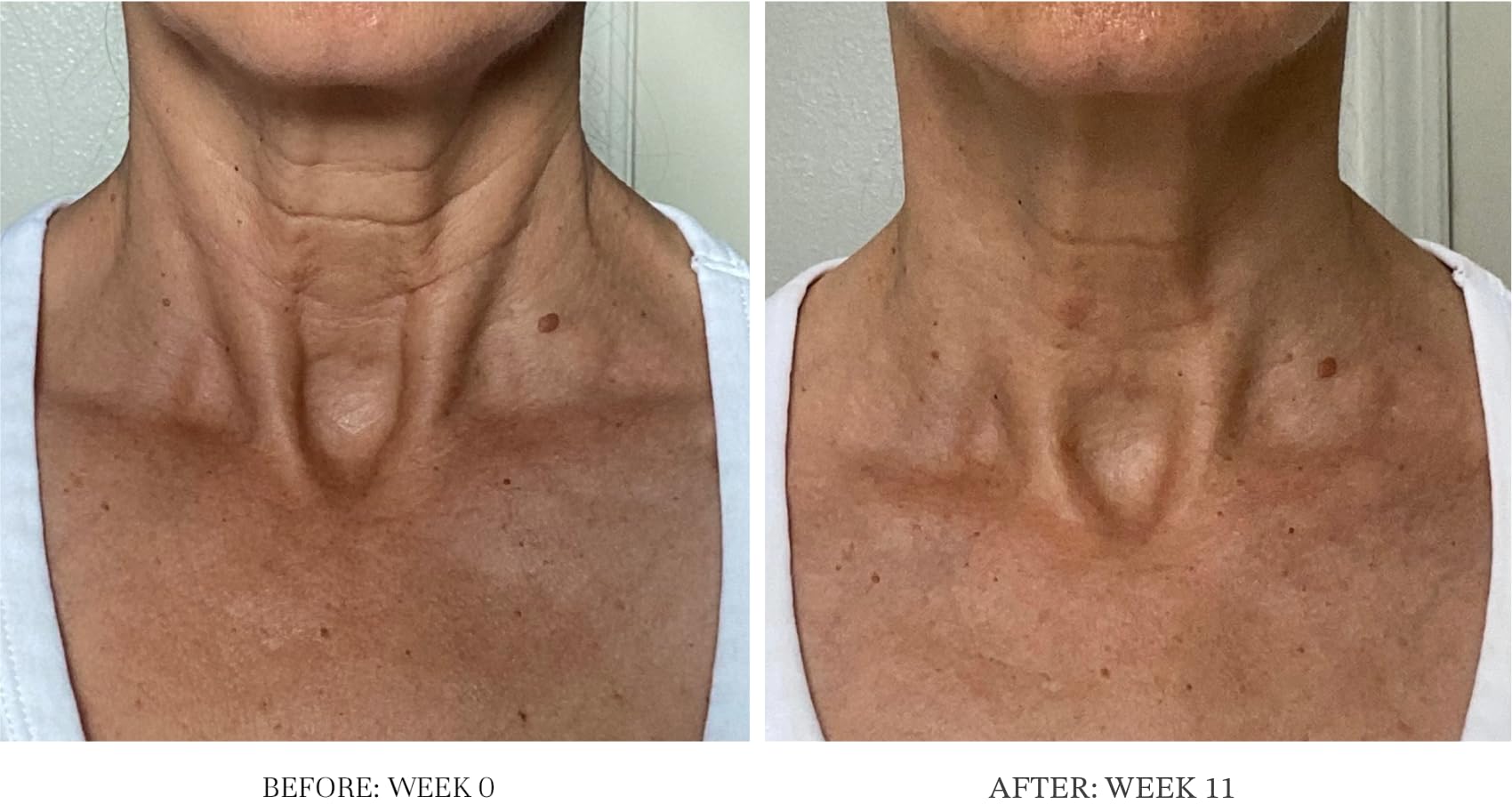 City Beauty Ultra-Firming Dry Oil applied to neck for uplift look