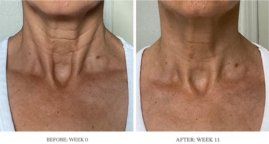 City Beauty Ultra-Firming Dry Oil applied to neck for uplift look