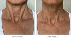City Beauty Ultra-Firming Dry Oil applied to neck for uplift look