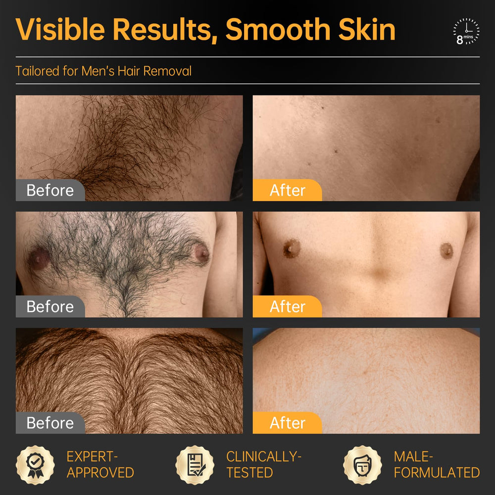 CKM Hair Removal Cream for Men on back hair with an ultra-clean finish.