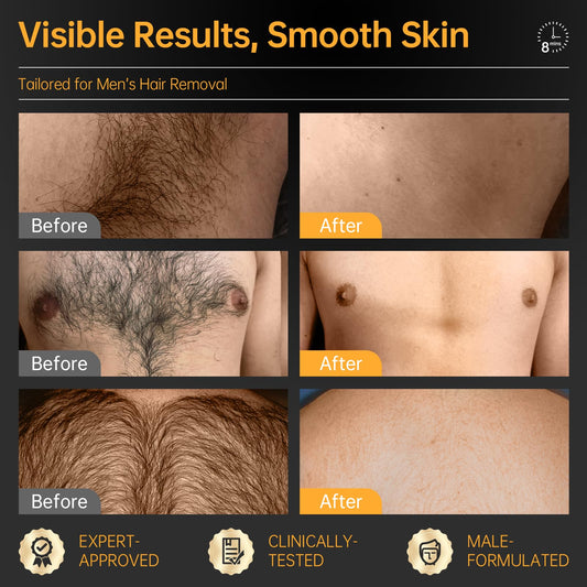 CKM Hair Removal Cream for Men on back hair with an ultra-clean finish.