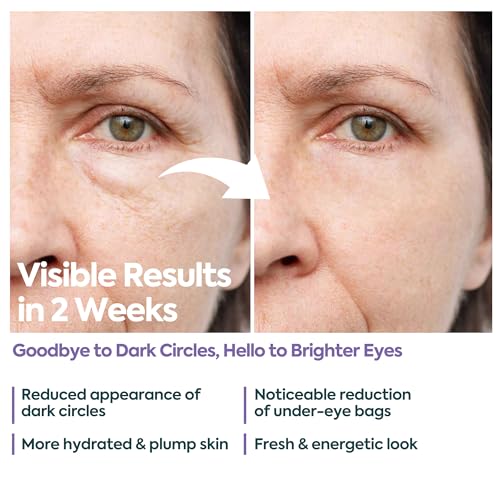 Clasy Care depuffs eye bags with caffeine for a fresher look