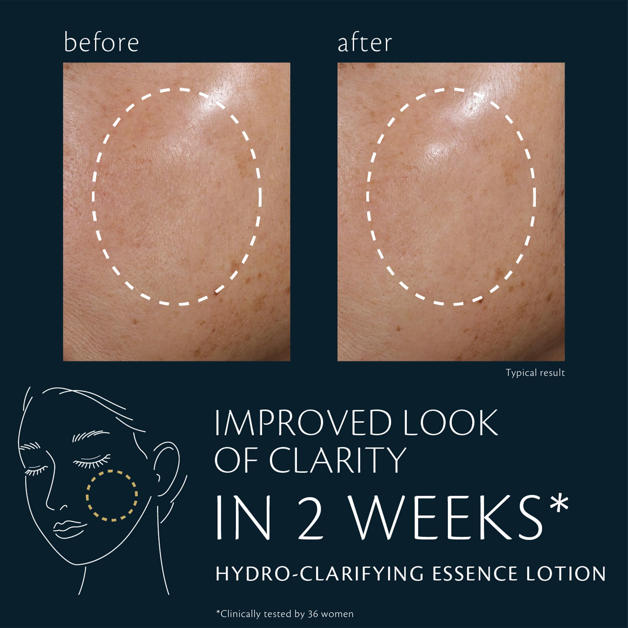 Clé de Peau Beauté Hydro-Clarifying Essence Lotion on hand shows silky texture for daily use