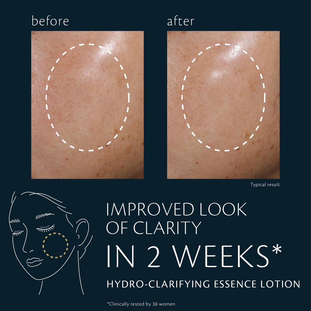 Clé de Peau Beauté Hydro-Clarifying Essence Lotion on hand shows silky texture for daily use