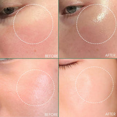CLIONE PRIME Skin Moisturizer jar closeup highlights rich, comforting cream.