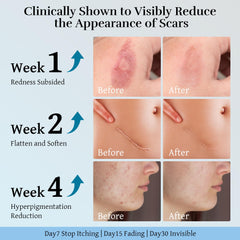 CLNABFR packaging reveals ingredients like dimethicone and hyaluronic acid