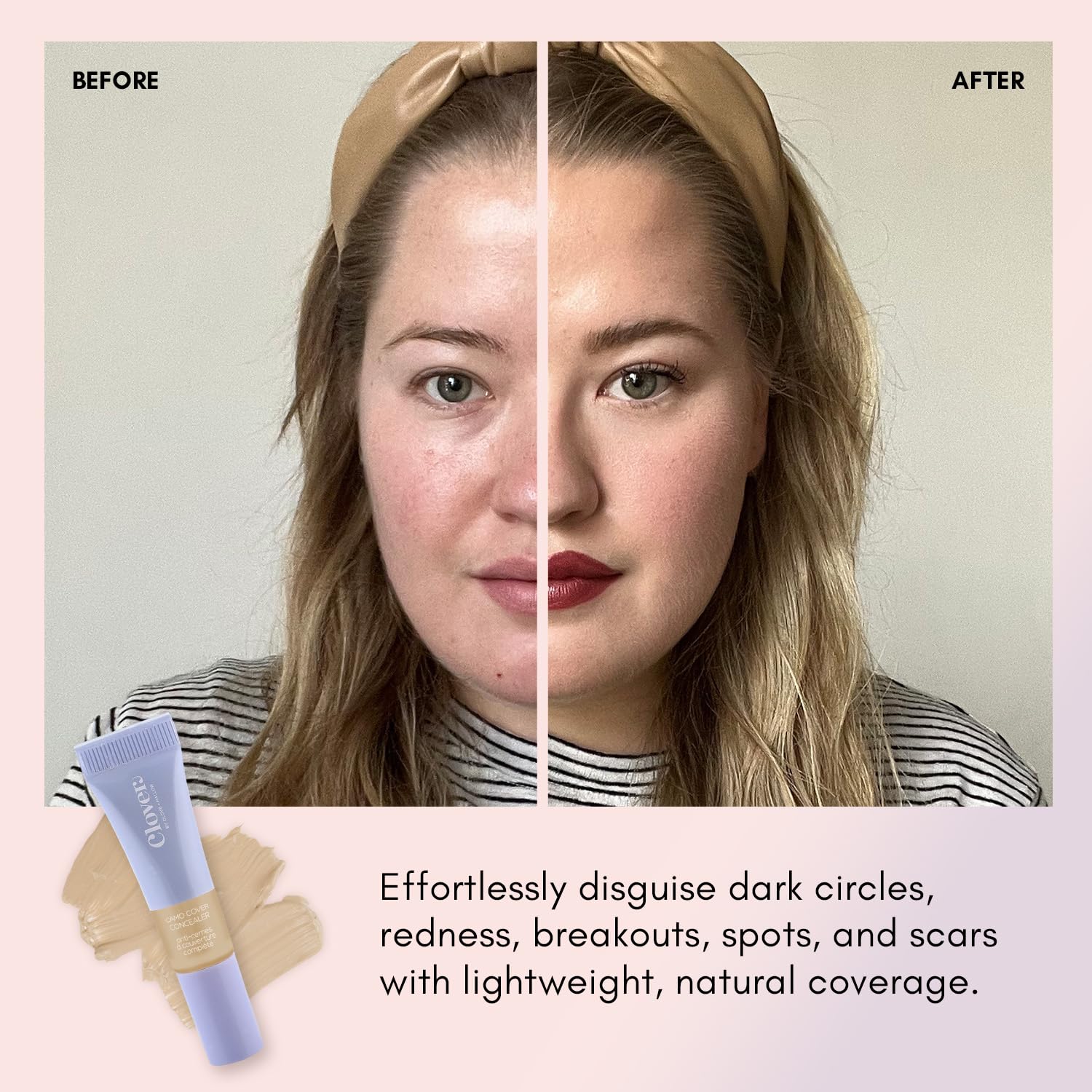 Clover Camo Cover offers 14 shade options for many skin tones.