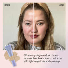 Clover Camo Cover offers 14 shade options for many skin tones.