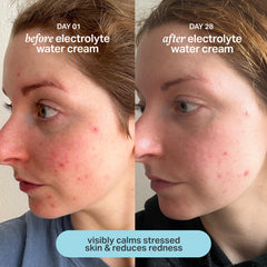 Cocokind Electrolyte Water Cream jar packaging highlights gentle, vegan, dermatologist-tested formula.