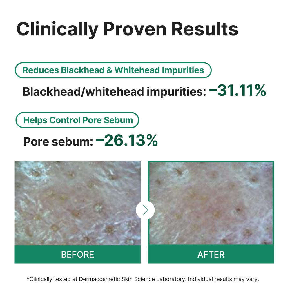 Bentonite and Kaolin in Coeternal mask purify pores and reduce shine.