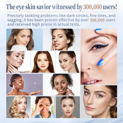 Coinore under-eye area appears refreshed after using the cream