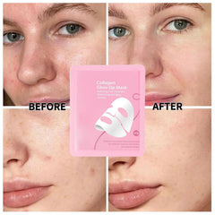 Collagen Glow Up Mask 2.0 demonstrating wrinkle reduction and firmer complexion.