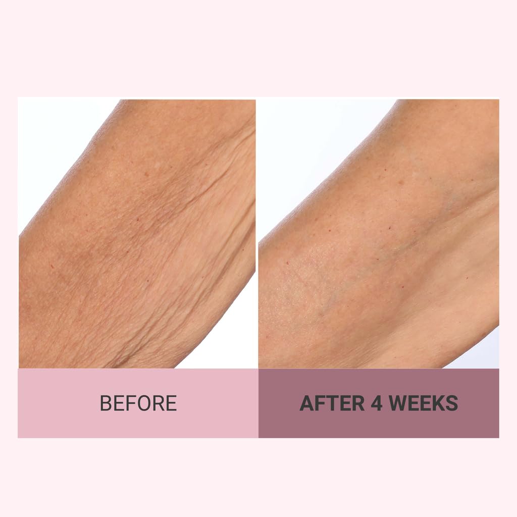 Consult Beaute Champagne Lift décolleté tightening scene shows renewed neckline appearance.