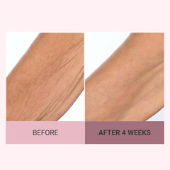 Consult Beaute Champagne Lift décolleté tightening scene shows renewed neckline appearance.