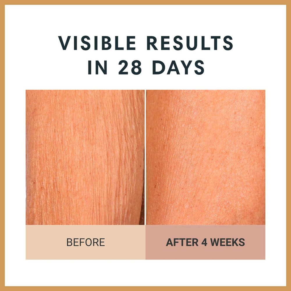 Consult Beaute Unscented Champagne Lift arm area—targets crepey skin.