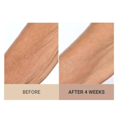 Consult Beaute Unscented Champagne Lift legs—softer, more hydrated tone.