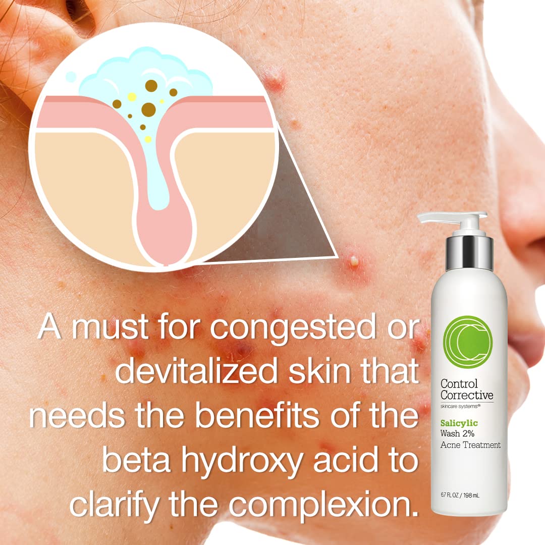 CONTROL CORRECTIVE Salicylic Wash ingredients panel highlights pore-clearing actives.