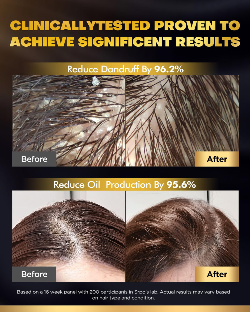 COOLKESI Shampoo and Conditioner set displayed together for versatile care.