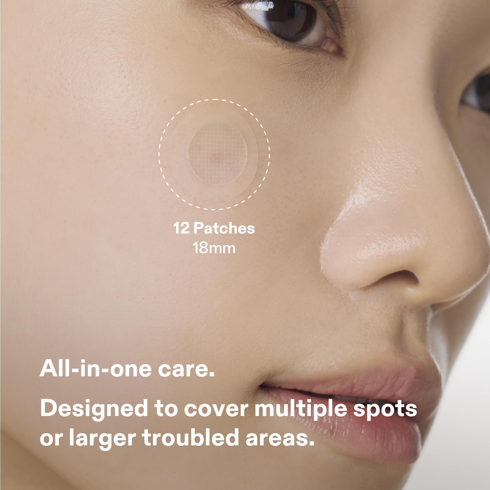 Cordiale salicylic acid patch clearing pores and impurities where needed.