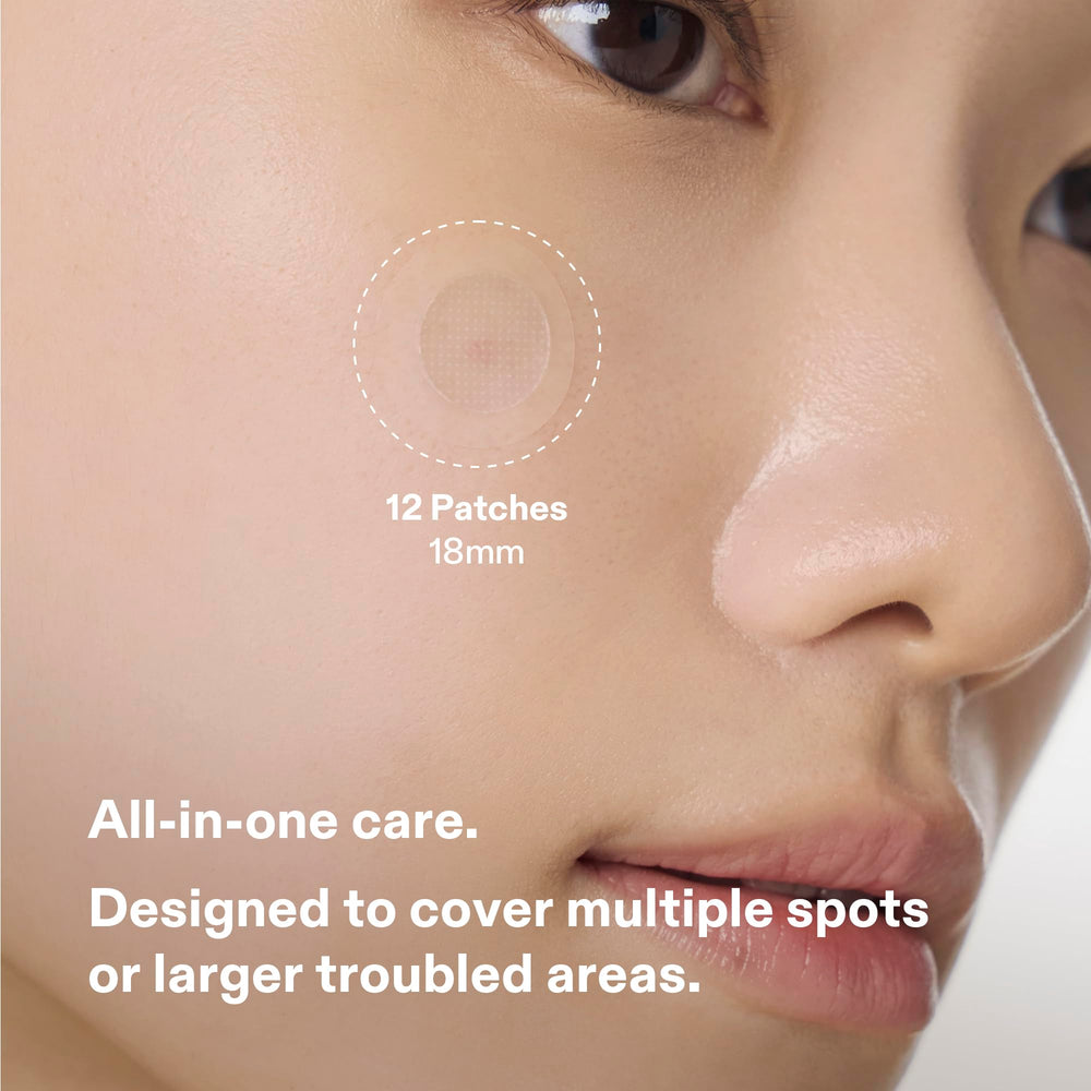 Cordiale salicylic acid patch clearing pores and impurities where needed.