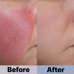 COSNOLOGY+ essence application on skin shows quick absorption and comfortable finish