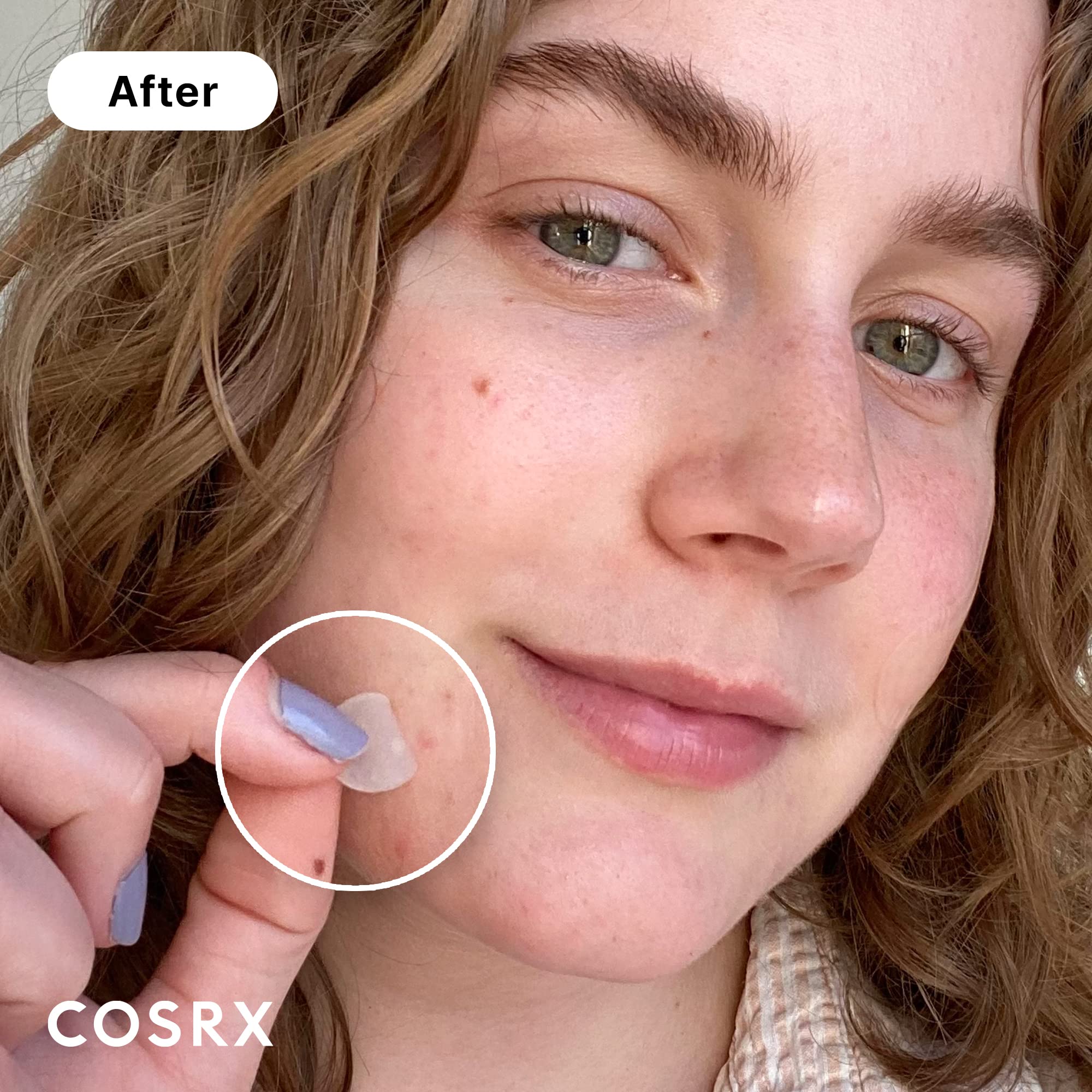 Applying the COSRX patch to a facial blemish for spot care.
