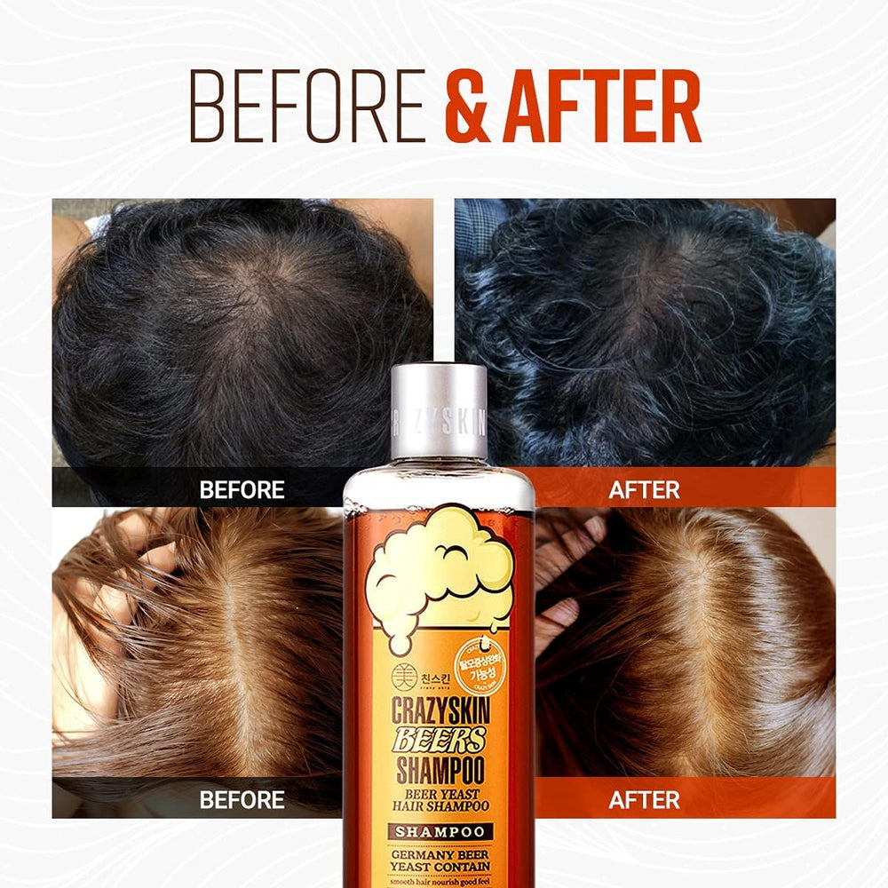 Crazy Skin German Beers Shampoo bottle back label highlights sulfate-free benefits
