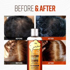 Crazy Skin German Beers Shampoo bottle back label highlights sulfate-free benefits