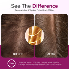 C'rcle unscented minoxidil foam label closeup emphasizes clean fragrance-free formula