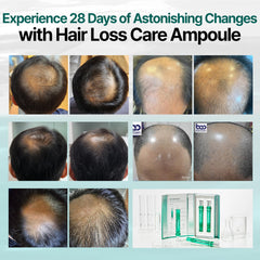 CrediThink BAO_H.LAB scalp application demonstrates easy daily use