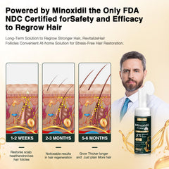 CUNVILEF 5% Minoxidil Foam close-up shows creamy texture aiding scalp care.