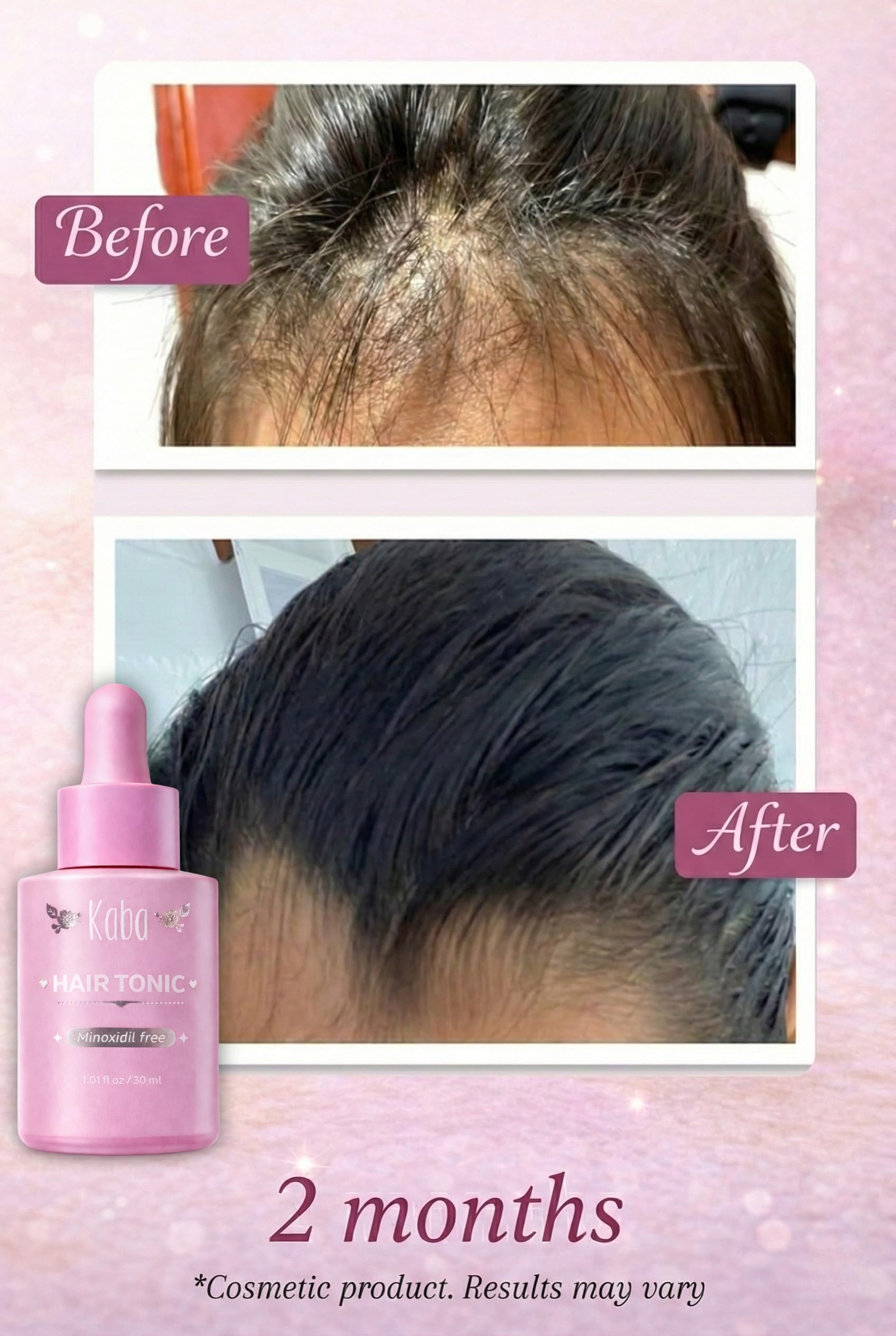D'Luchi Kaba Tonic dropper enables precise scalp application.