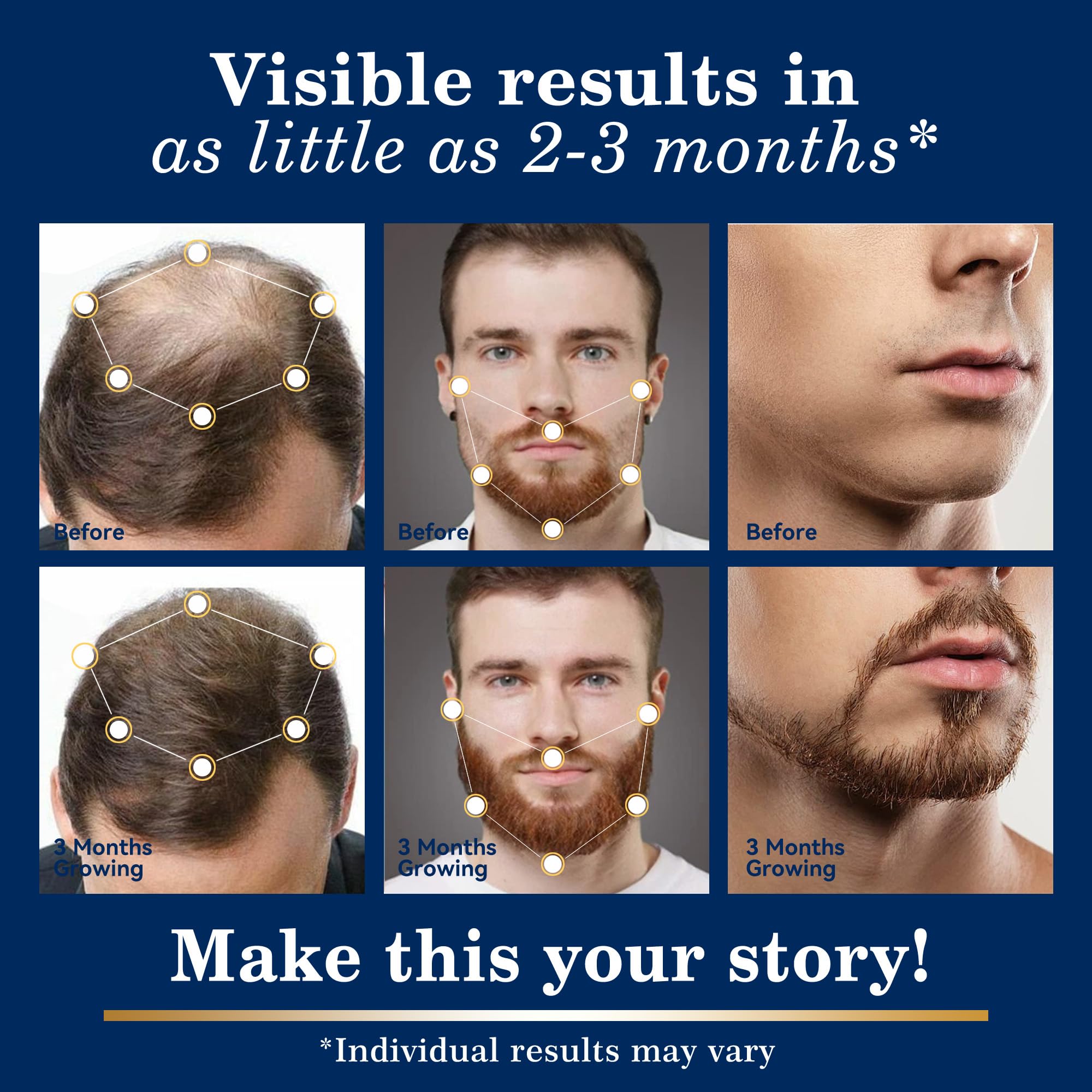 DAAZZS scalp thinning support highlights thinning areas and density appearance.
