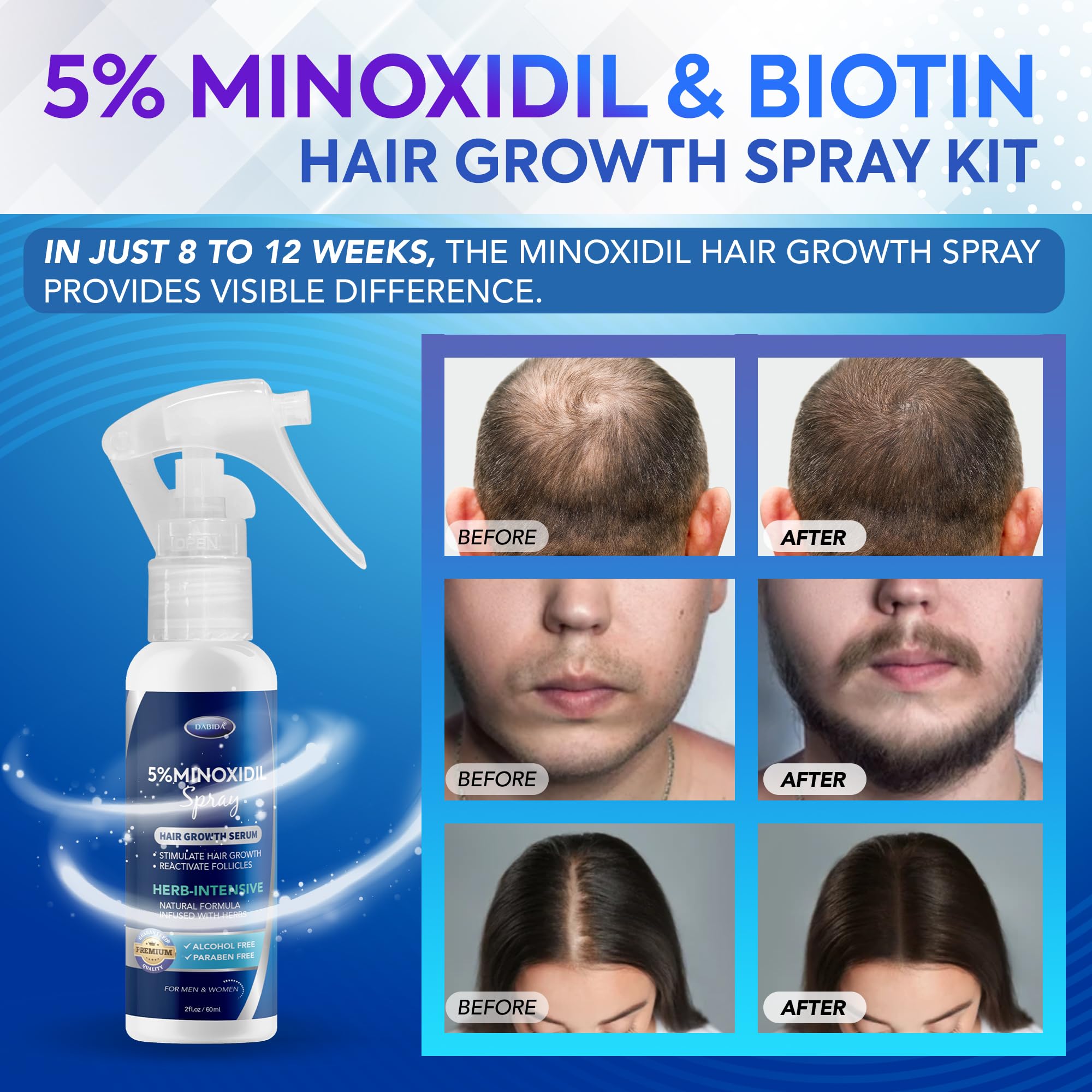 DABIDA Minoxidil 5% bottle side view for easy spray use.