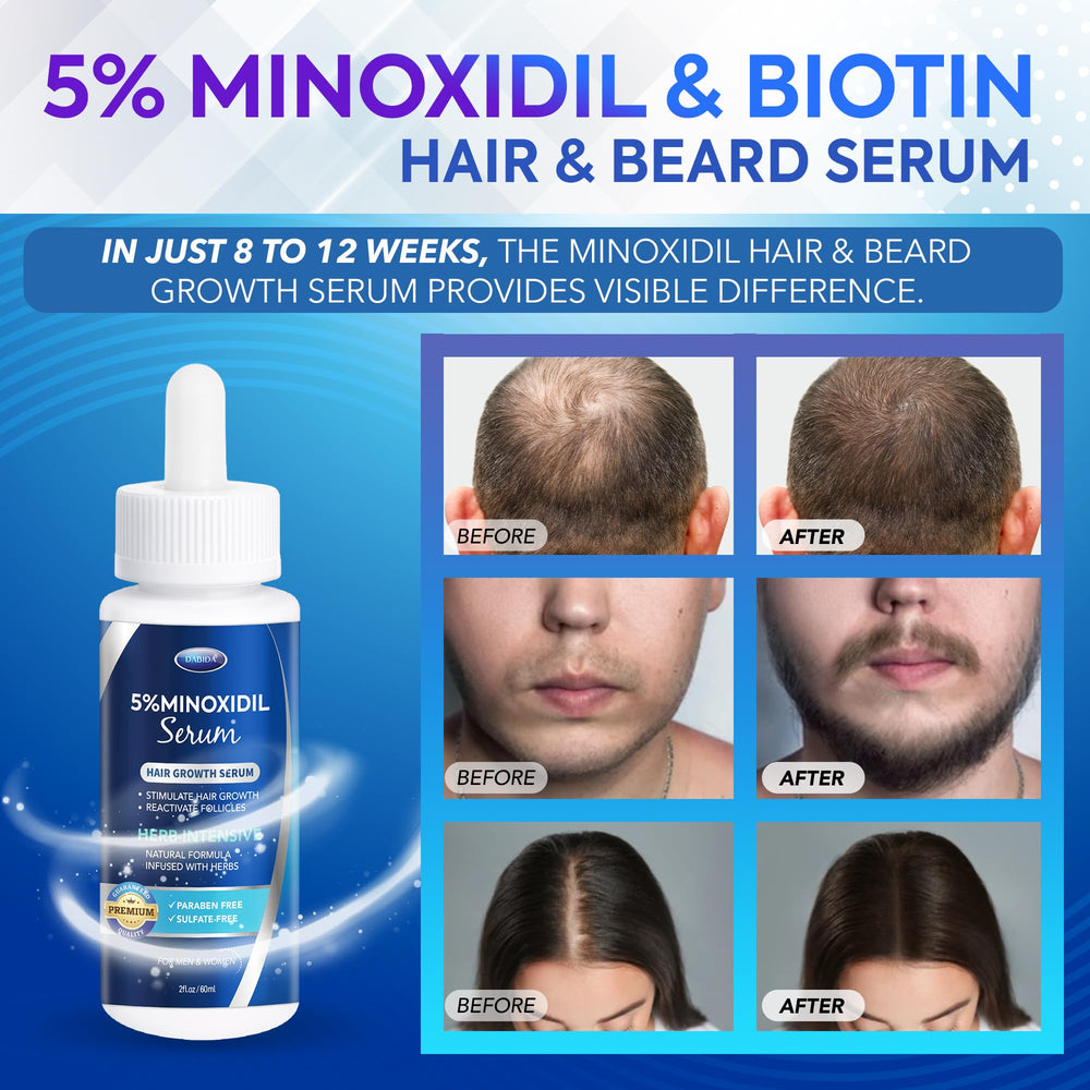 DABIDA minoxidil dropper application demonstrates precise dosing for problem areas.