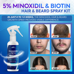 DABIDA minoxidil spray nozzle close-up for precise scalp application