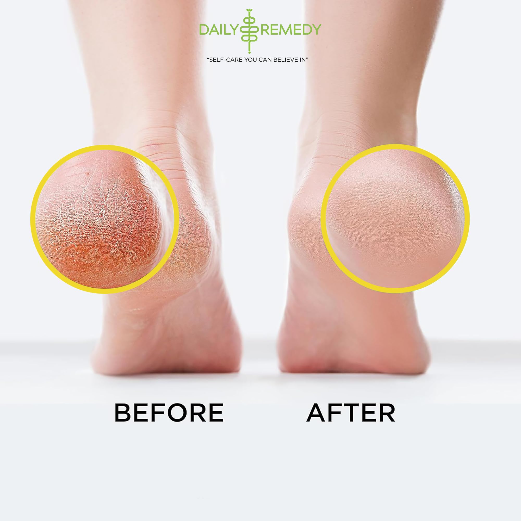 Daily Remedy Citrus Detox Foot Soak salts dissolve to begin a soothing foot bath.