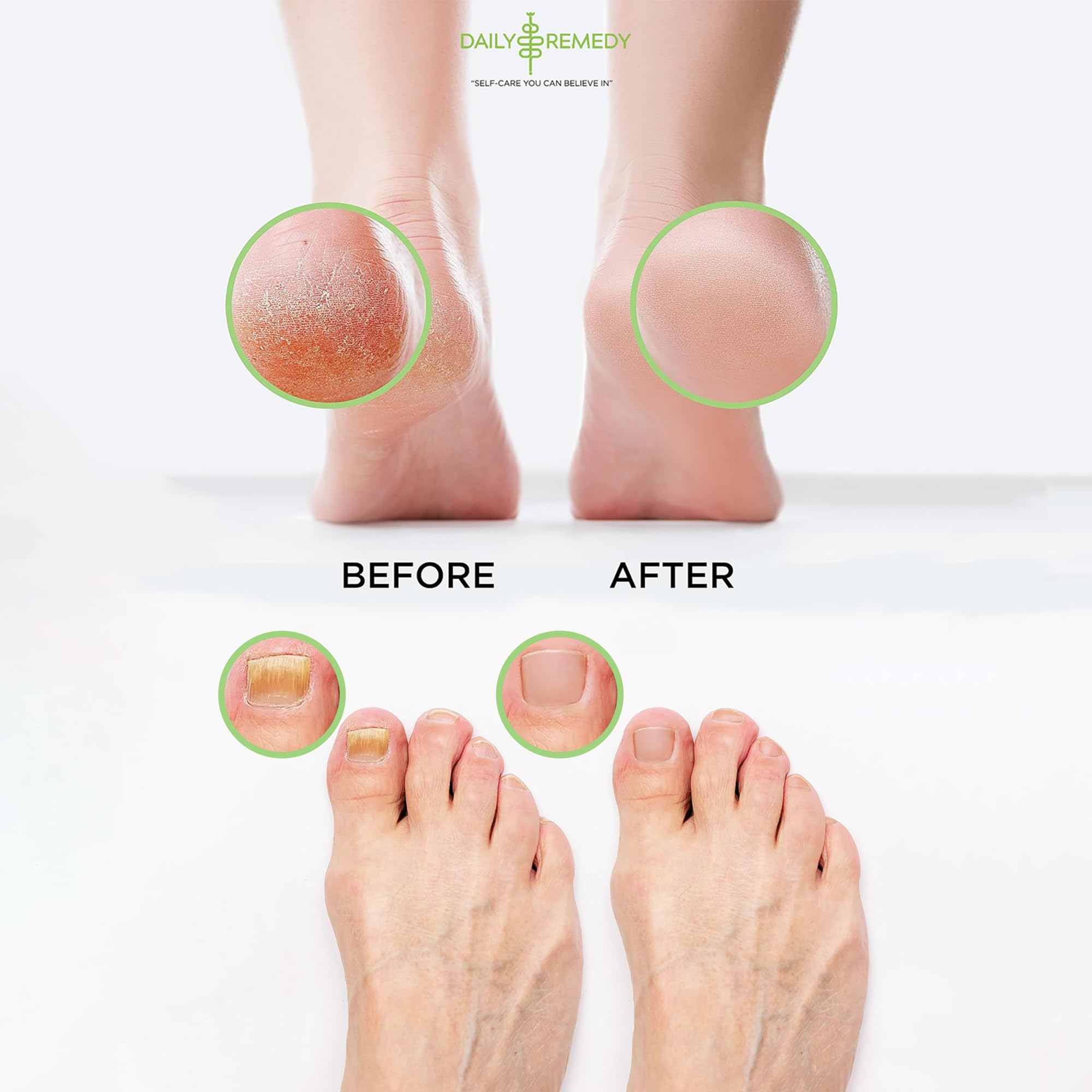 Daily Remedy foot soak with epsom salts and natural herbs