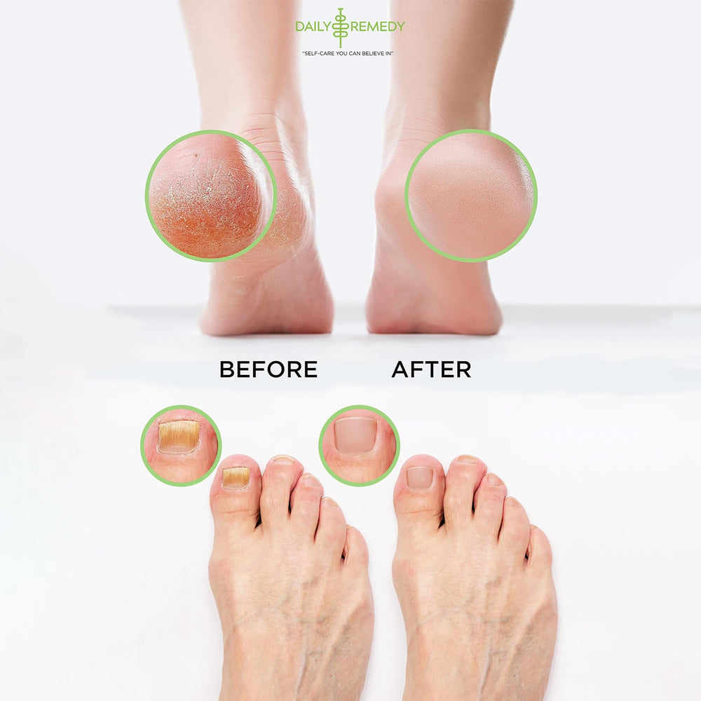 Daily Remedy foot soak with epsom salts and natural herbs