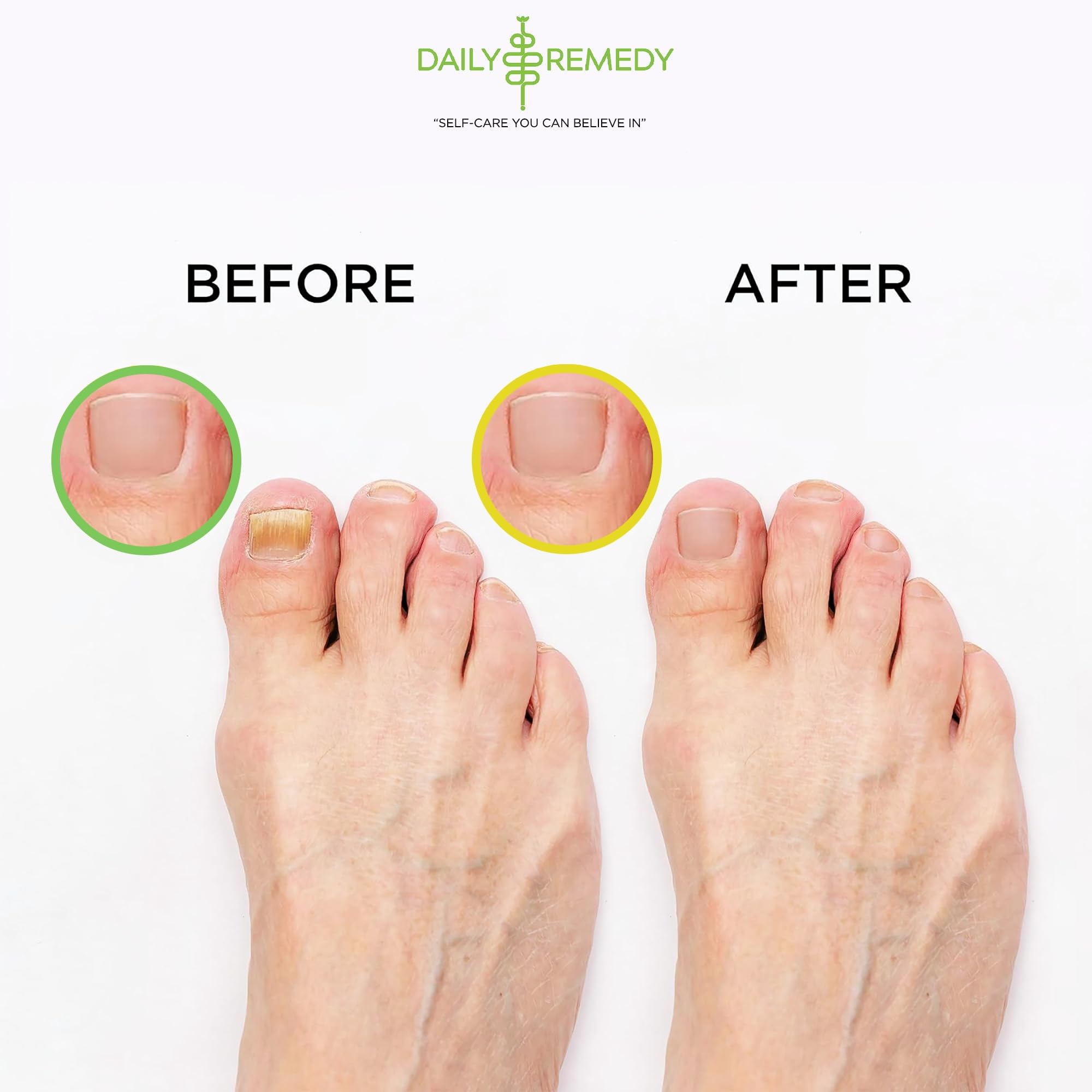Feet soaking in a basin with Daily Remedy foot soak for at-home spa moment