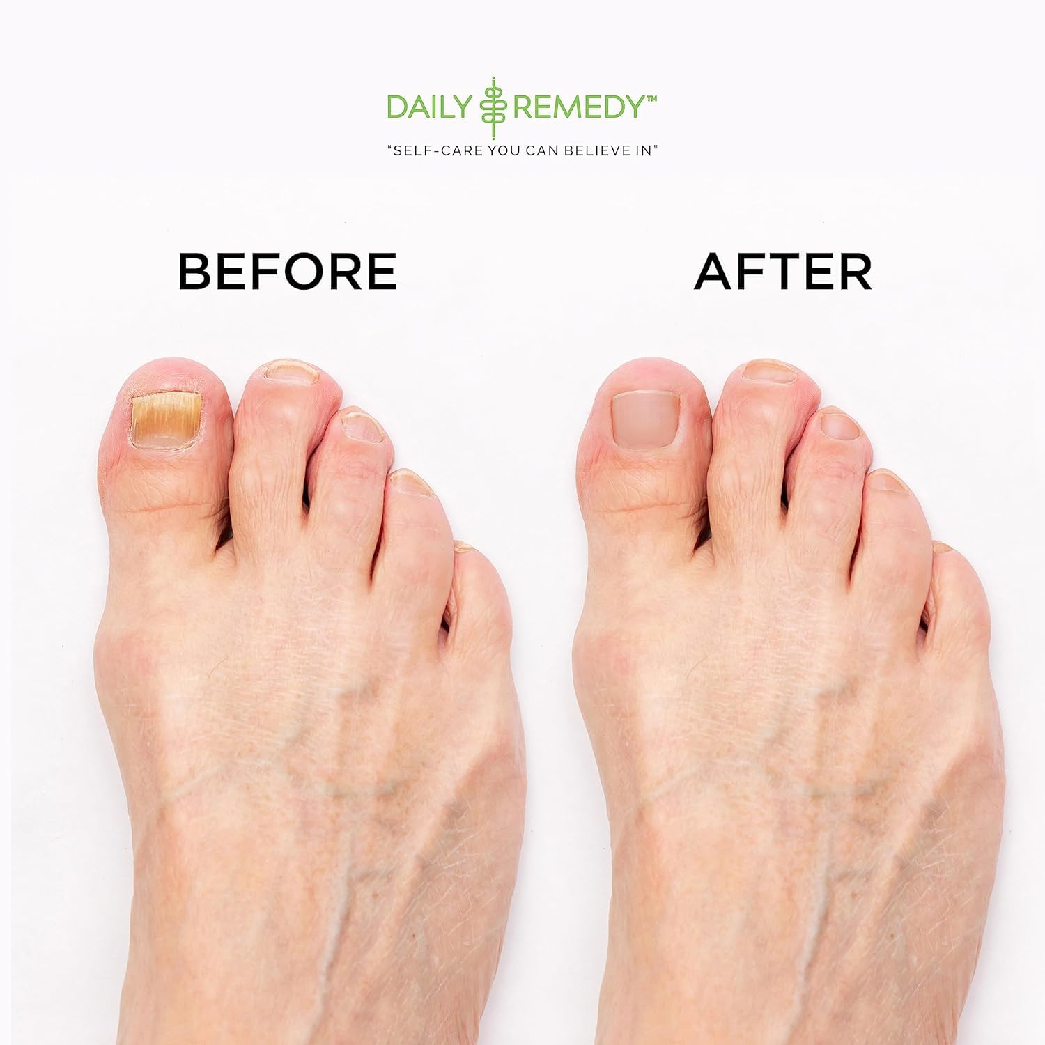 Packaging featuring Daily Remedy made-in-USA label on premium foot soak box.