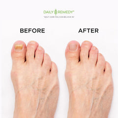 Packaging featuring Daily Remedy made-in-USA label on premium foot soak box.