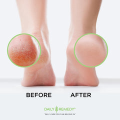 DAILY REMEDY pedicure-quality foot soak for an at-home spa day.