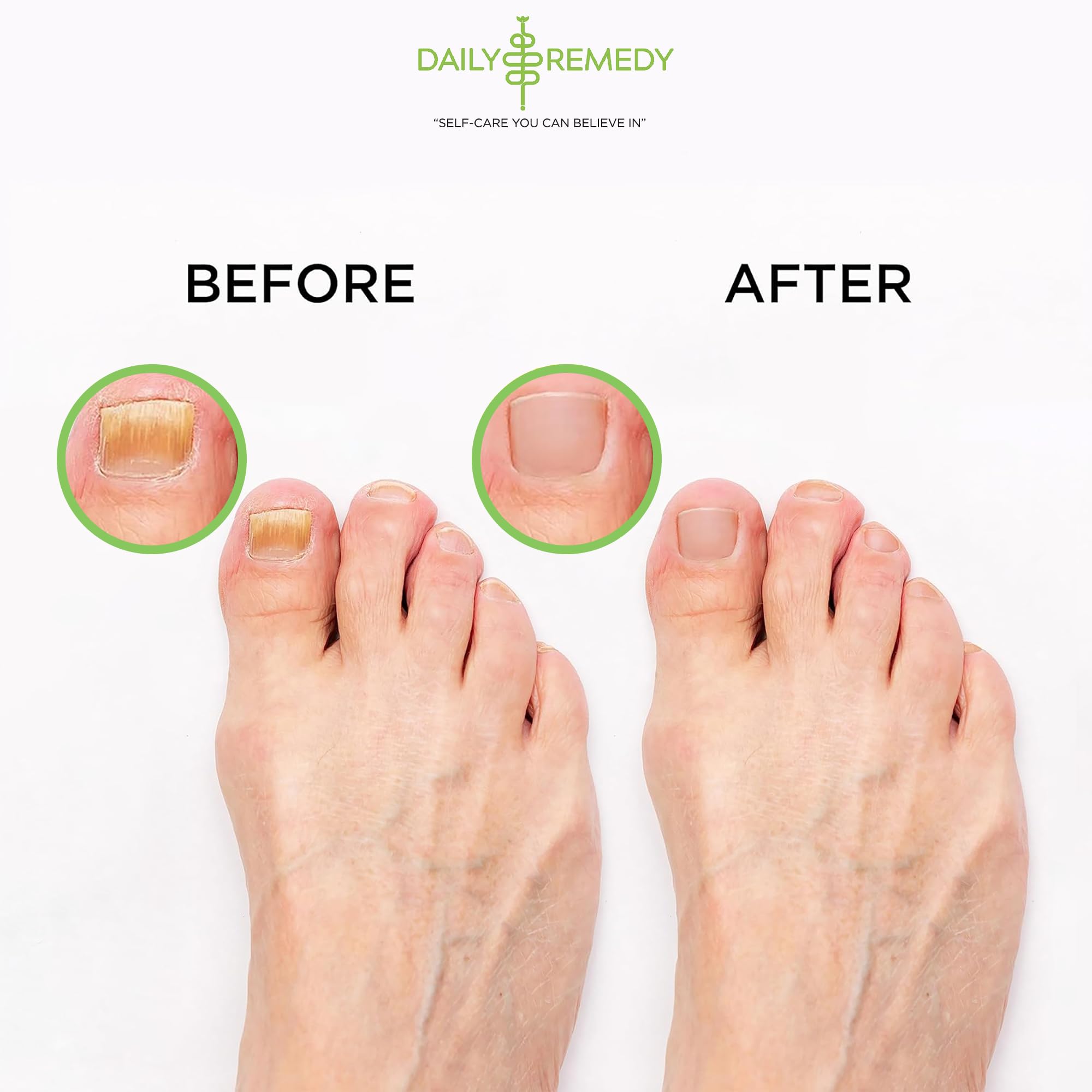 Daily Remedy Tea Tree Foot Soak spa-like home treatment