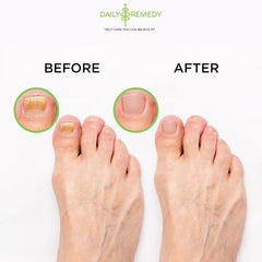 Daily Remedy Tea Tree Foot Soak spa-like home treatment