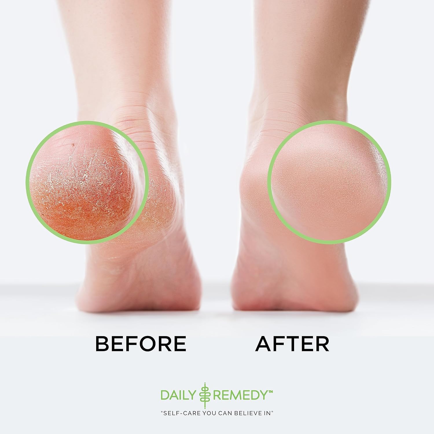 Two-pack Daily Remedy foot soak packaging showing value and convenience.