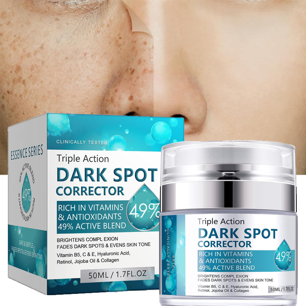 Dark Spot Cream bottle shown for facial use with brightening focus