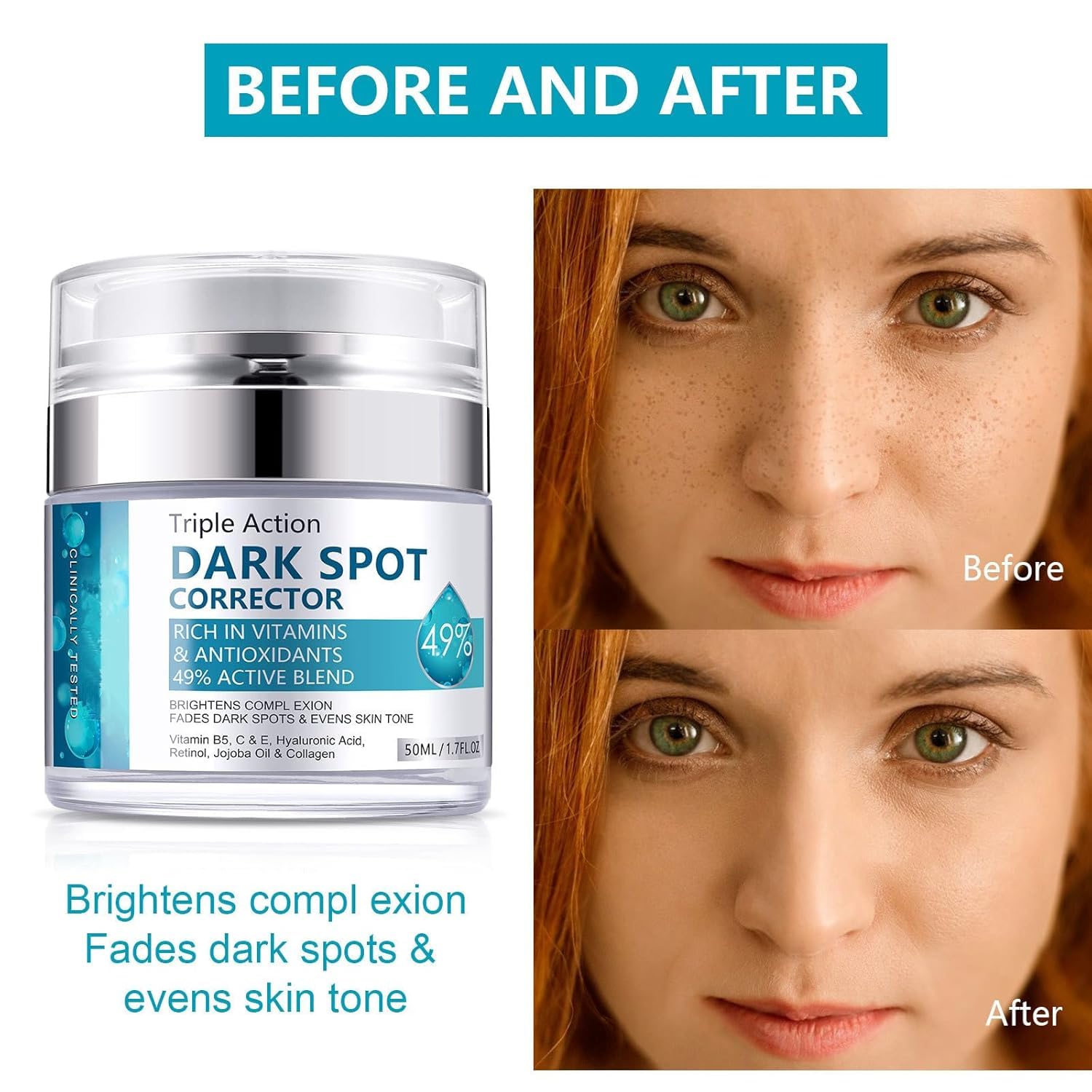 Fresh, hydrated complexion after applying Dark Spot Cream