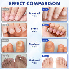 Datunsu discolored nails before-after view shows improved appearance.